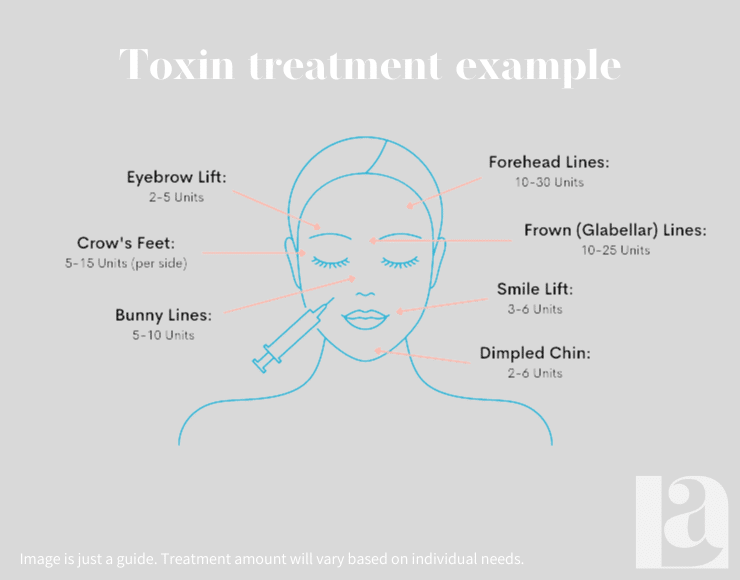 Botox-Treatment-Examples